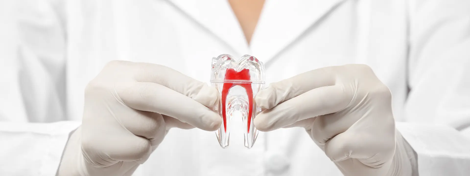 Endodoncia Picuadent Endodoncia Picuadent